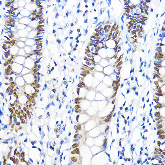 GTF2B Rabbit polyclonal antibody