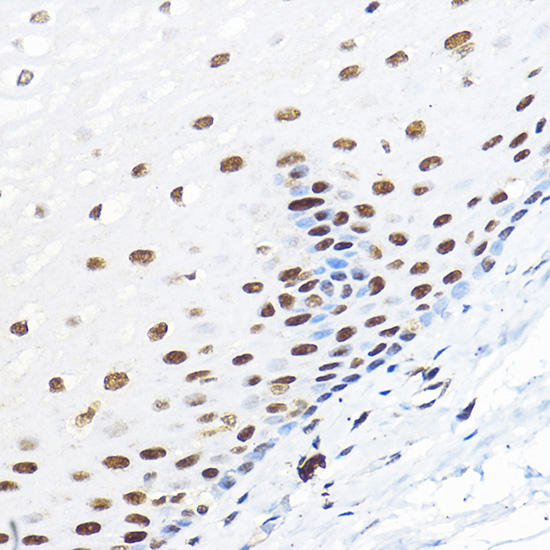 GTF2B Rabbit polyclonal antibody