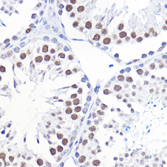 GTF2B Rabbit polyclonal antibody