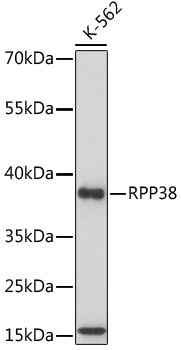RPP38 Rabbit polyclonal antibody