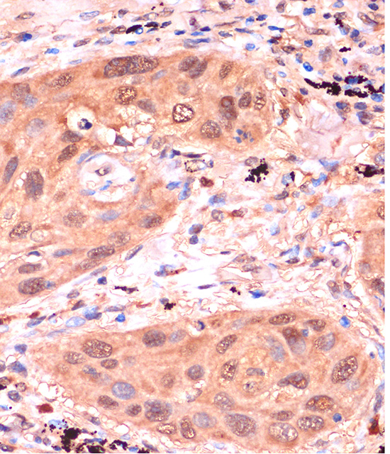 RPP38 Rabbit polyclonal antibody