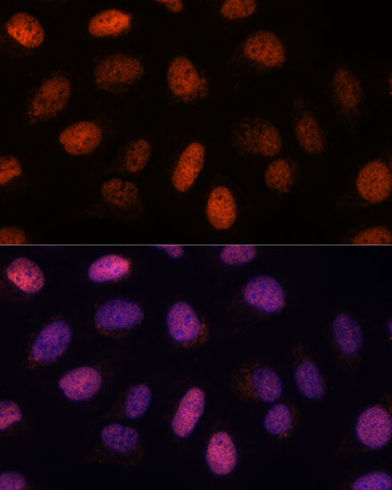 RPP38 Rabbit polyclonal antibody