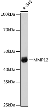 MMP12 Rabbit polyclonal antibody