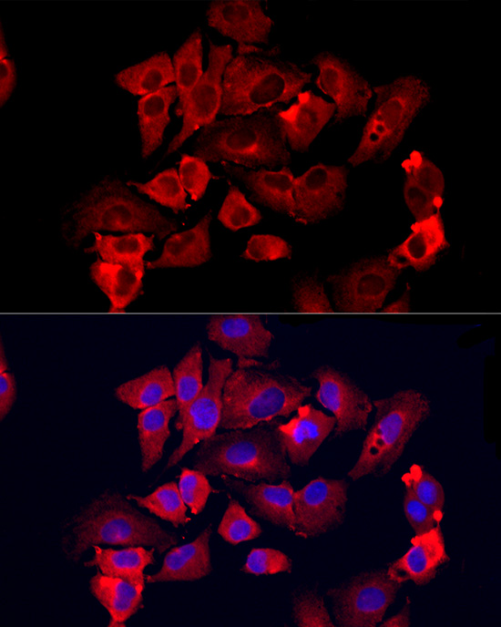 MMP12 Rabbit polyclonal antibody