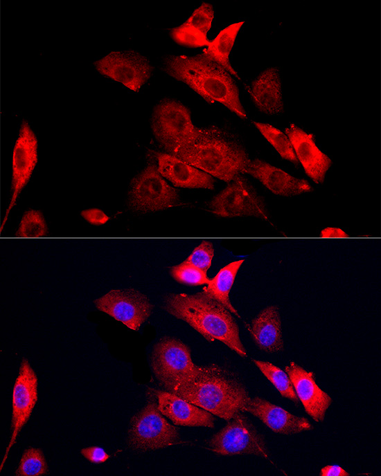 MMP12 Rabbit polyclonal antibody