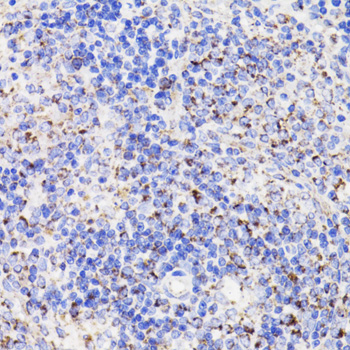 PDCD10 Rabbit polyclonal antibody
