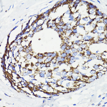 PDCD10 Rabbit polyclonal antibody
