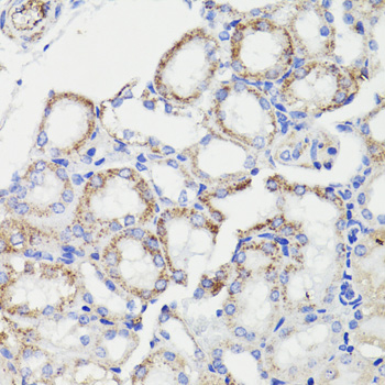 PDCD10 Rabbit polyclonal antibody