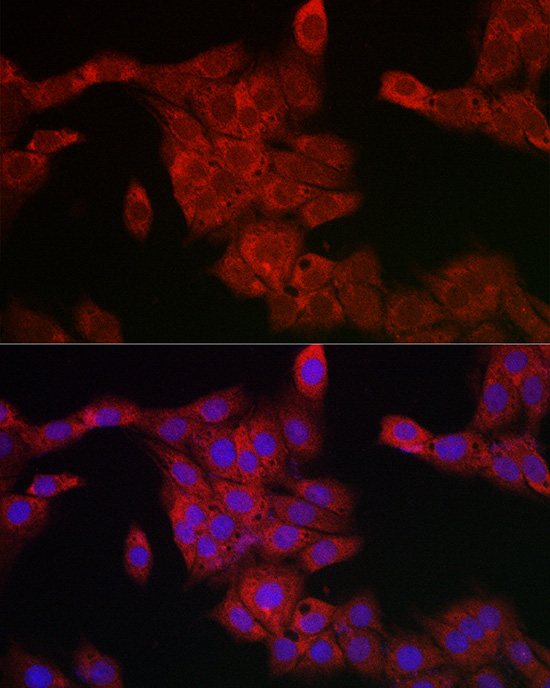 PDCD10 Rabbit polyclonal antibody