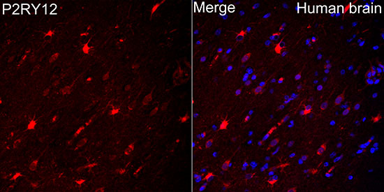 P2RY12 Rabbit polyclonal antibody