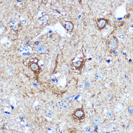 WWC1 Rabbit polyclonal antibody