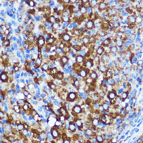 WWC1 Rabbit polyclonal antibody