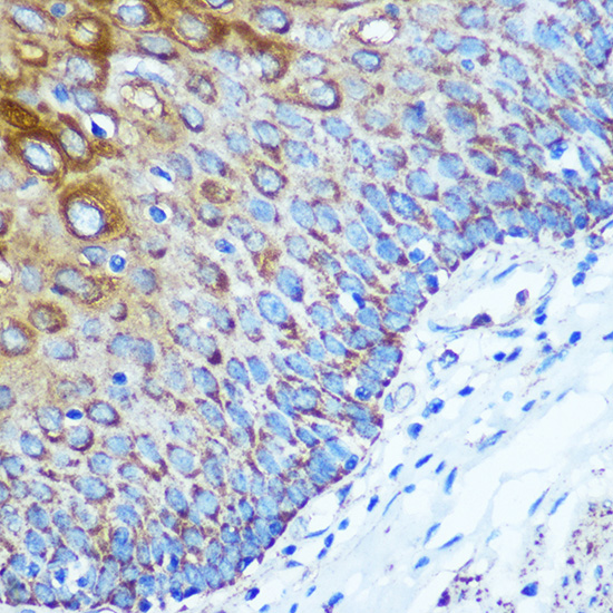 WWC1 Rabbit polyclonal antibody