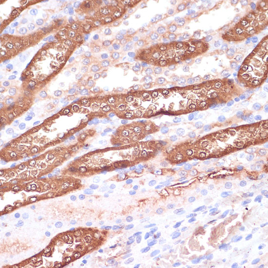 GEMIN5 Rabbit polyclonal antibody