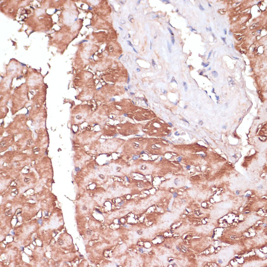 GEMIN5 Rabbit polyclonal antibody