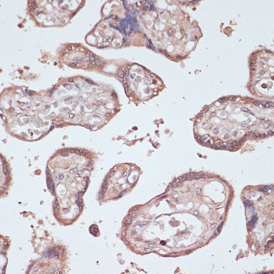 GEMIN5 Rabbit polyclonal antibody
