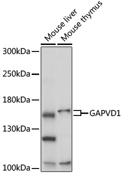 GAPVD1 Rabbit polyclonal antibody