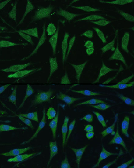 GAPVD1 Rabbit polyclonal antibody