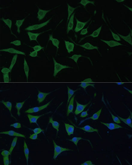 HIBCH Rabbit polyclonal antibody