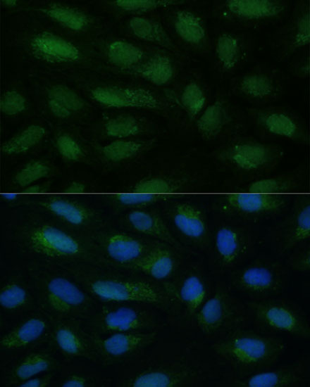 HIBCH Rabbit polyclonal antibody