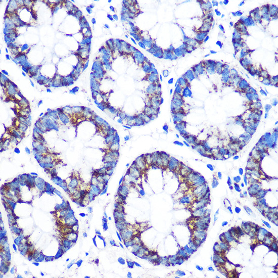 CYP11A1 Rabbit polyclonal antibody