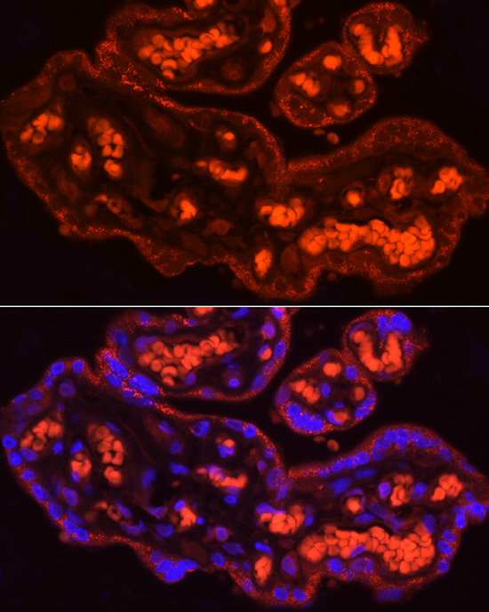CYP11A1 Rabbit polyclonal antibody