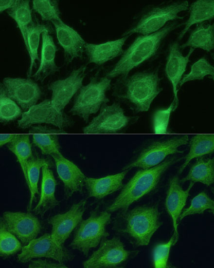 CNNM1 Rabbit polyclonal antibody