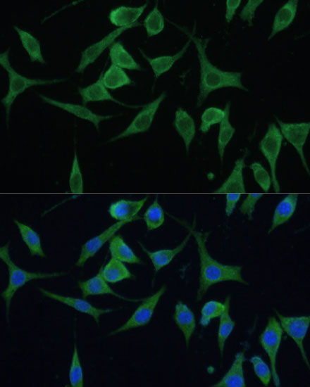 CNNM1 Rabbit polyclonal antibody