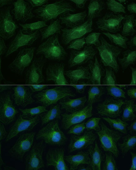CNNM1 Rabbit polyclonal antibody