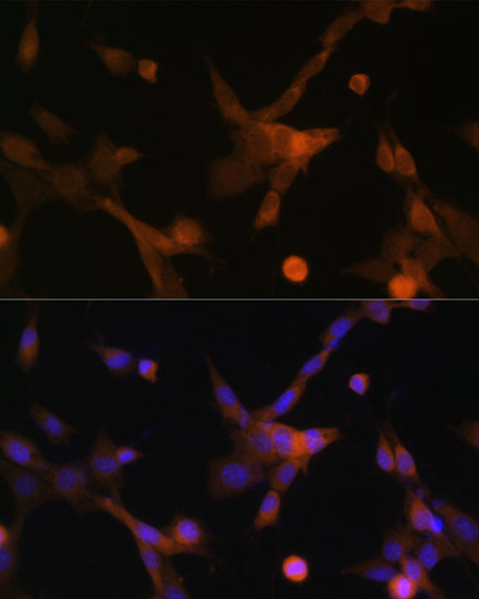 PUMA Rabbit polyclonal antibody