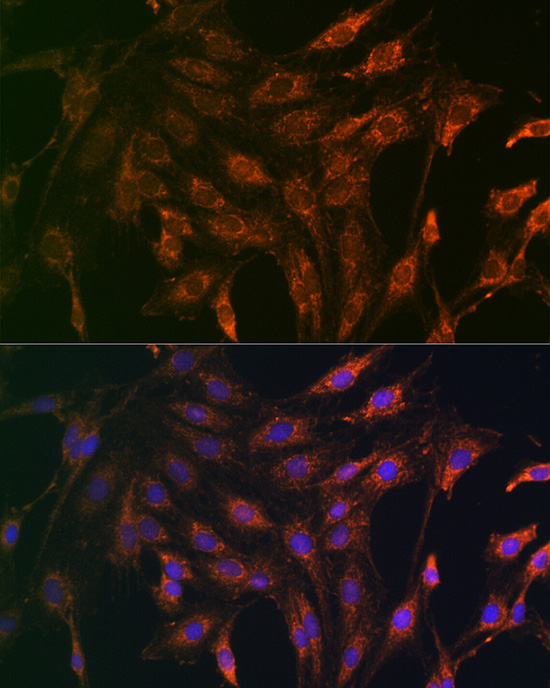 DKK3 Rabbit polyclonal antibody