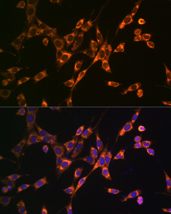 DKK3 Rabbit polyclonal antibody
