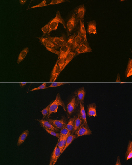 DKK3 Rabbit polyclonal antibody