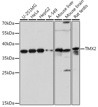TMX2 Rabbit polyclonal antibody