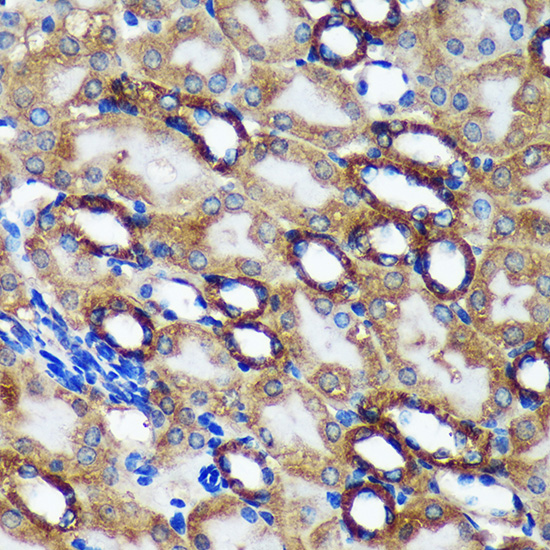 TMX2 Rabbit polyclonal antibody