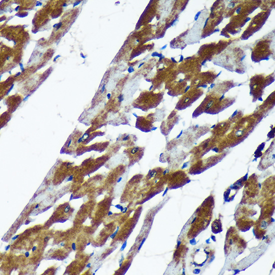 TMX2 Rabbit polyclonal antibody