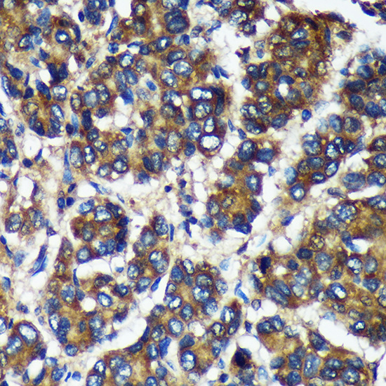 TMX2 Rabbit polyclonal antibody
