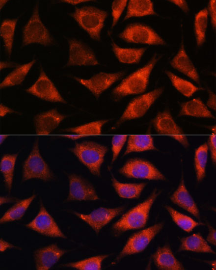 TMX2 Rabbit polyclonal antibody