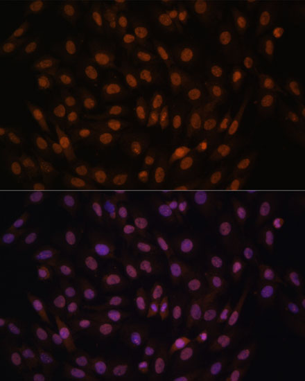FCF1 Rabbit polyclonal antibody