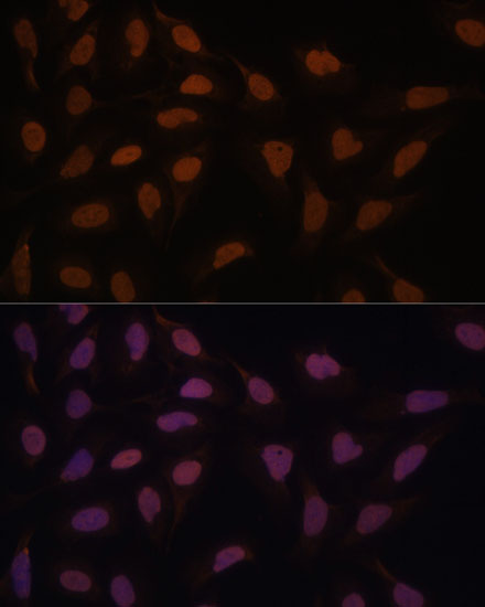 FCF1 Rabbit polyclonal antibody