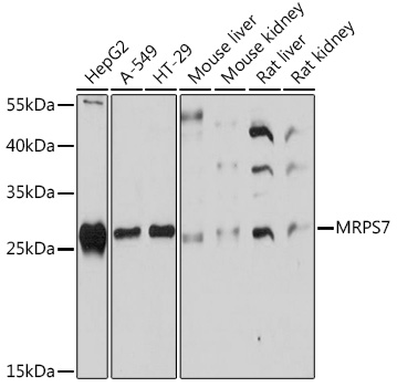 MRPS7 Rabbit polyclonal antibody