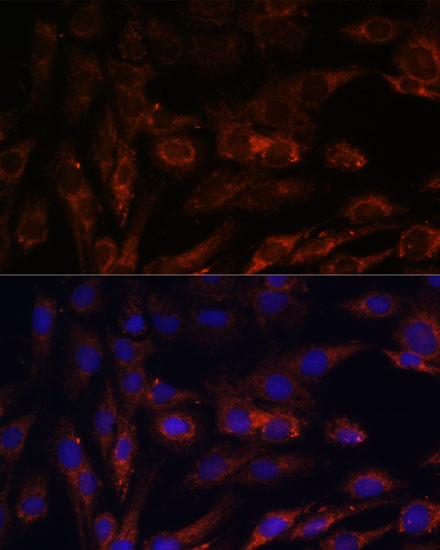 MRPS7 Rabbit polyclonal antibody