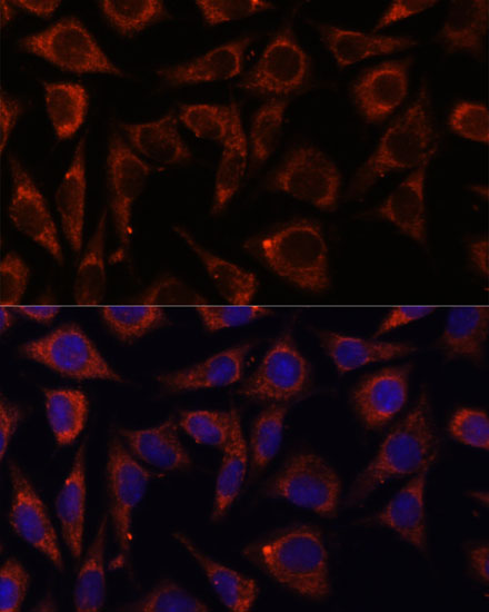 MRPS7 Rabbit polyclonal antibody