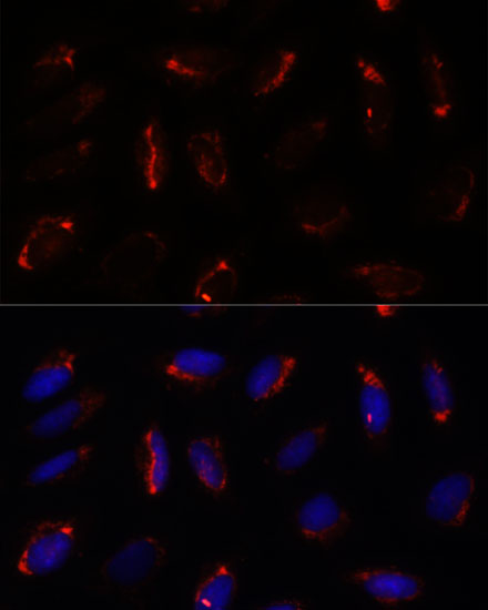 MRPS7 Rabbit polyclonal antibody