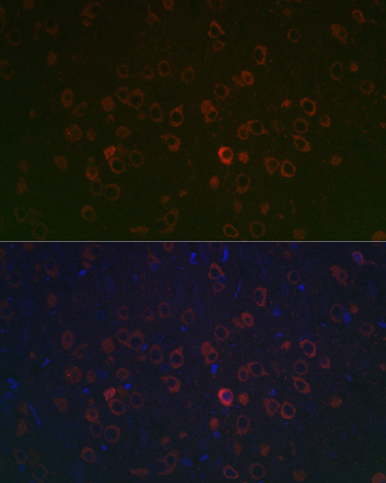 REEP2 Rabbit polyclonal antibody