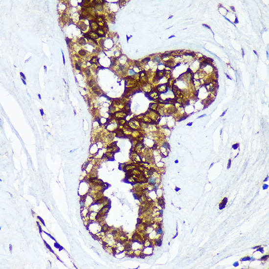 HSD17B7 Rabbit polyclonal antibody