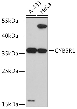CYB5R1 Rabbit polyclonal antibody