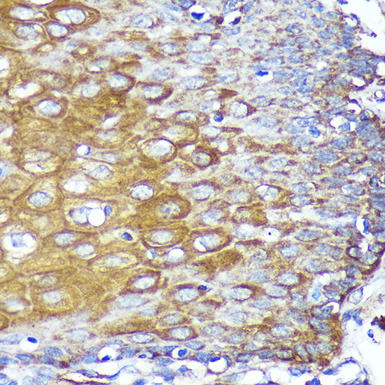 CYB5R1 Rabbit polyclonal antibody