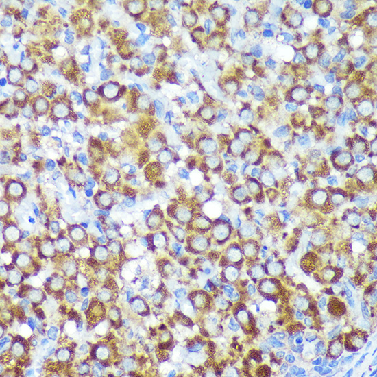 CYB5R1 Rabbit polyclonal antibody