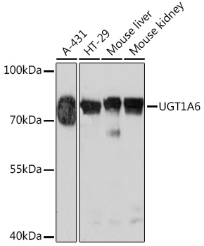 UGT1A6 Rabbit polyclonal antibody